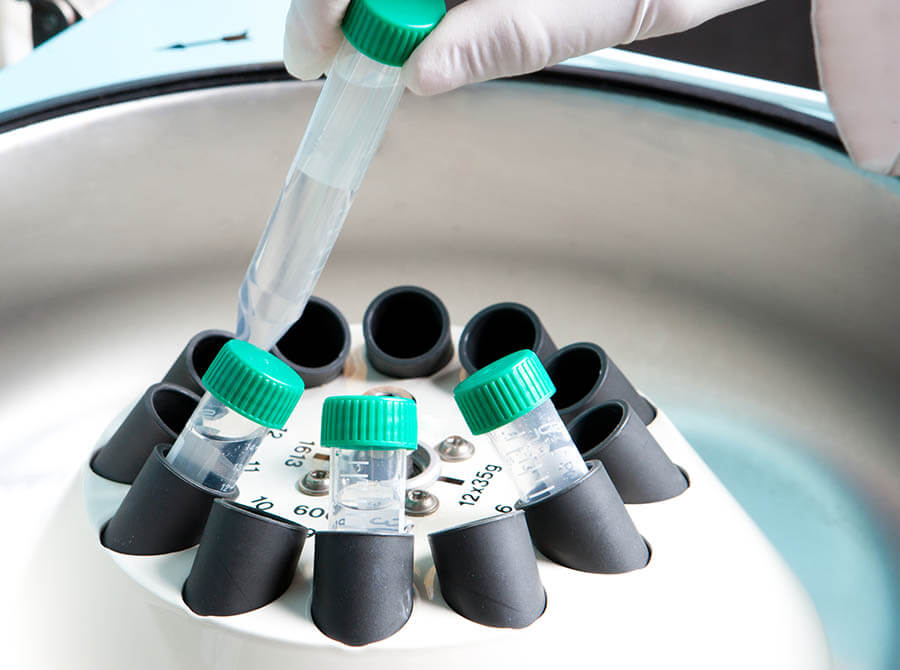Hemoglobin tests